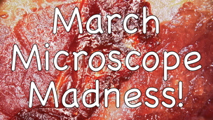 March Microscope Madness! (Week 4 - 2016)